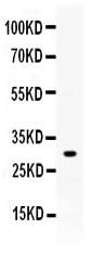 Anti-ZWINT Antibody Picoband® Boster Bio