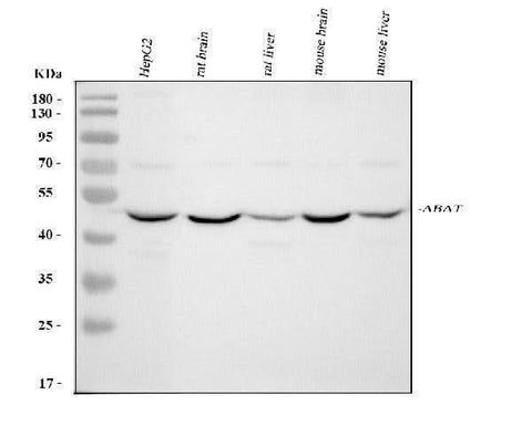 Anti-ABAT Antibody Picoband® Boster Bio