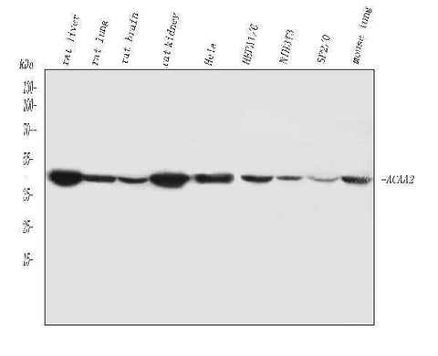 Anti-ACAA2 Antibody Picoband® Boster Bio
