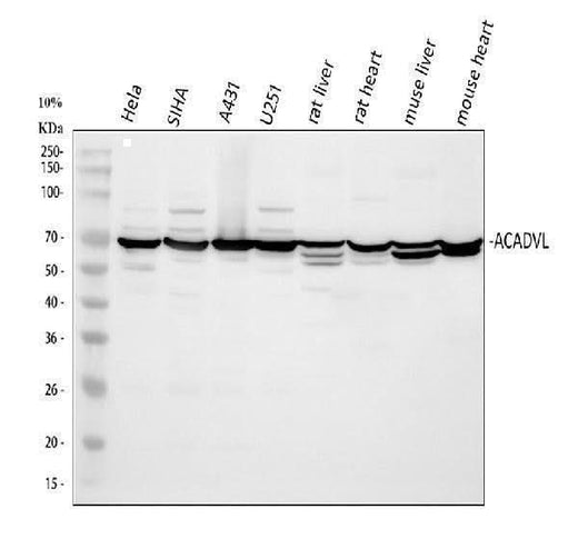 Anti-ACADVL Antibody Picoband® Boster Bio