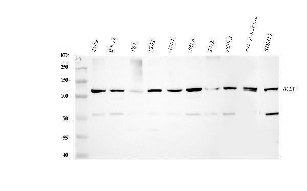Anti-ATP citrate lyase/ACLY Antibody Picoband® Boster Bio
