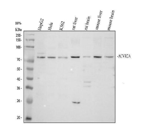 Anti-Activin Receptor Type IIA/ACVR2A Antibody Picoband® Boster Bio