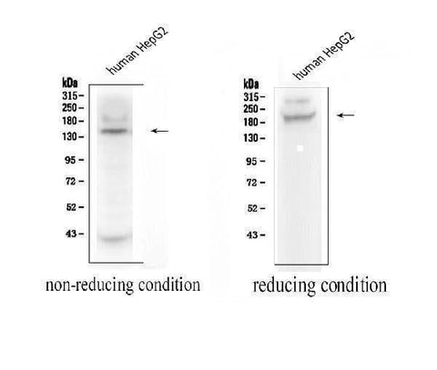 Anti-ADAMTS13 Antibody Picoband® Boster Bio