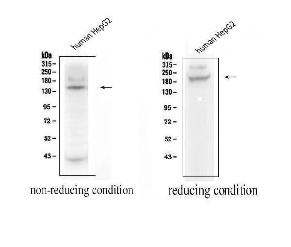 Anti-ADAMTS13 Antibody Picoband® Boster Bio