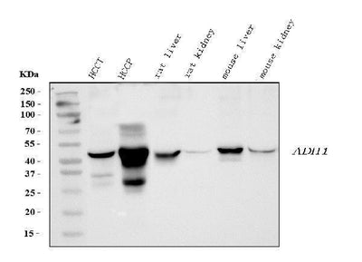 Anti-Alcohol Dehydrogenase/ADH1A Antibody Picoband® Boster Bio