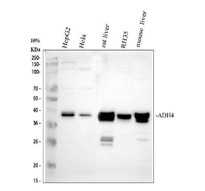 Anti-ADH4 Antibody Picoband® Boster Bio