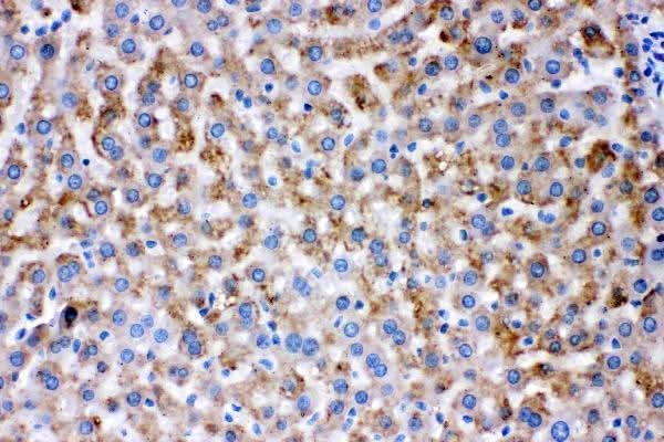 Anti-AK2 Antibody Picoband® Boster Bio