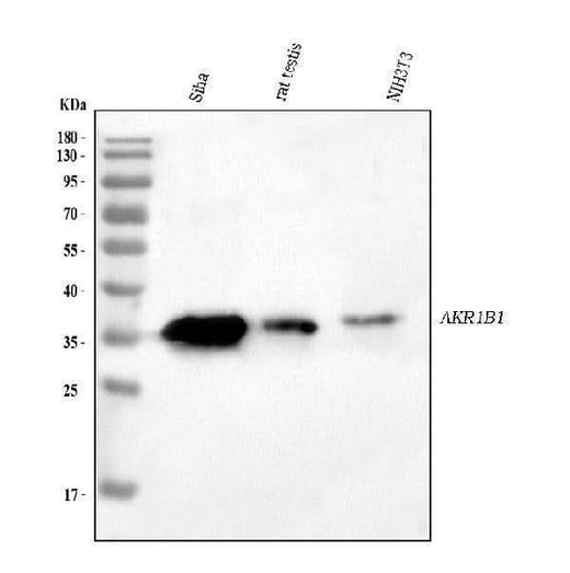 Anti-AKR1B1 Antibody Picoband® Boster Bio