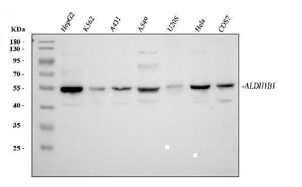 Anti-ALDH1B1 Antibody Picoband® Boster Bio