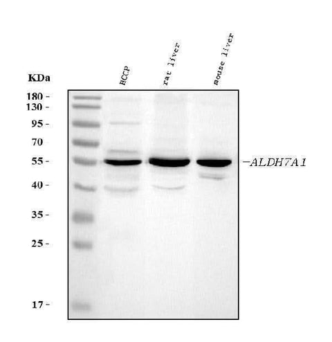 Anti-ALDH7A1 Antibody Picoband® Boster Bio