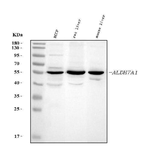 Anti-ALDH7A1 Antibody Picoband® Boster Bio