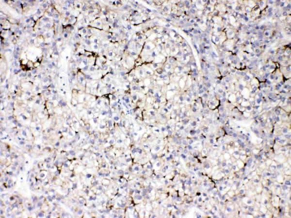 Anti-Apolipoprotein B/APOB Antibody Picoband® Boster Bio