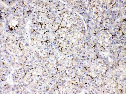 Anti-Apolipoprotein B/APOB Antibody Picoband® Boster Bio