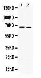 Anti-ACCN1/ASIC2 Antibody Picoband® Boster Bio