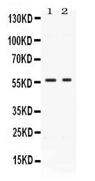 Anti-BMP15 Antibody Picoband® Boster Bio