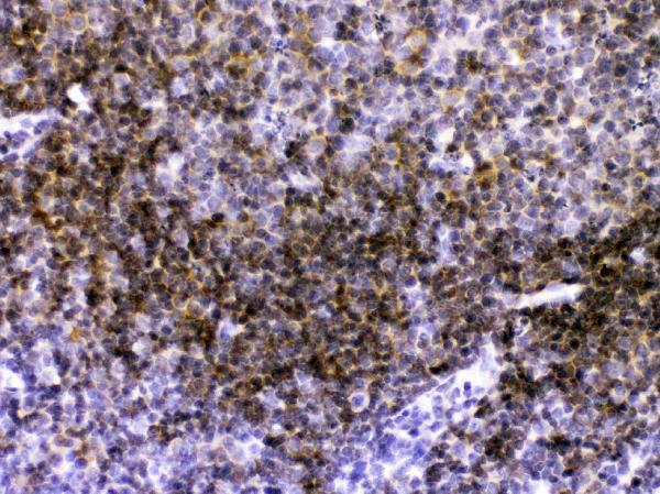 Anti-CD40 Antibody Picoband® Boster Bio