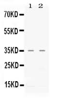 Anti-CXCL16 Antibody Picoband® Boster Bio