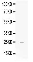 Anti-FGF19 Antibody Picoband® Boster Bio