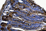 Anti-Fgf19(Fgf15) Antibody Boster Bio