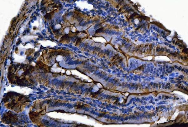Anti-Fgf19(Fgf15) Antibody Boster Bio