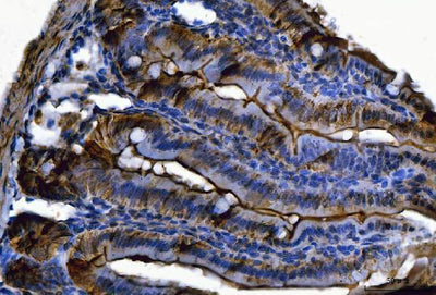 Anti-Fgf19(Fgf15) Antibody Boster Bio
