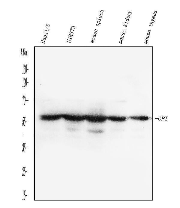 Anti-Glucose 6 phosphate isomerase/GPI Antibody Picoband® Boster Bio