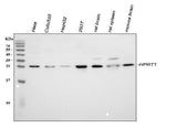 Anti-HPRT/HPRT1 Antibody Picoband® Boster Bio