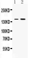 Anti-Insulin Receptor/INSR Antibody Picoband® Boster Bio