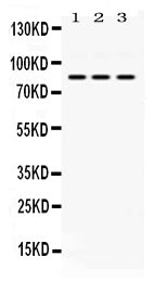 Anti-KRIT1 Antibody Picoband® Boster Bio