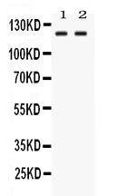Anti-LRIG3 Antibody Picoband® Boster Bio