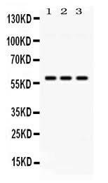 Anti-E3 SUMO-protein ligase PIAS4 Antibody Picoband® Boster Bio