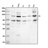 Anti-PML Protein Antibody Picoband® Boster Bio