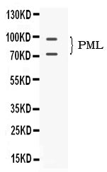 Anti-PML Protein Antibody Picoband® Boster Bio