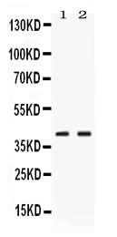Anti-Phosphoserine Aminotransferase/PSAT1 Antibody Picoband® Boster Bio