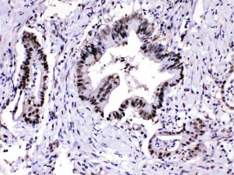 Anti-Proteasome 20S alpha 3/PSMA3 Antibody Picoband® Boster Bio