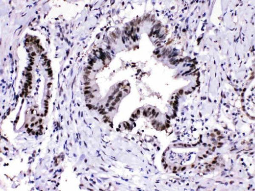 Anti-Proteasome 20S alpha 3/PSMA3 Antibody Picoband® Boster Bio