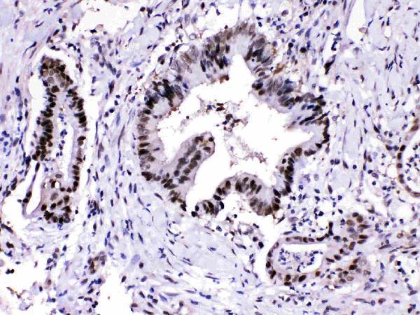 Anti-Proteasome 20S alpha 3/PSMA3 Antibody Picoband® Boster Bio