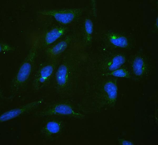 Anti-RPL19 Antibody Picoband® Boster Bio