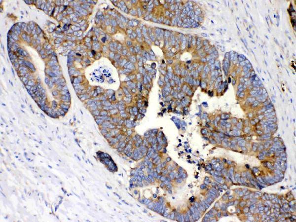 Anti-MPS1/RPS27 Antibody Picoband® Boster Bio