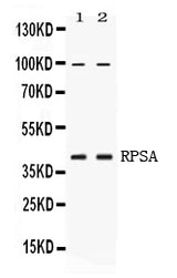 Anti-67kDa Laminin Receptor/RPSA Antibody Picoband® Boster Bio