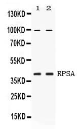 Anti-67kDa Laminin Receptor/RPSA Antibody Picoband® Boster Bio