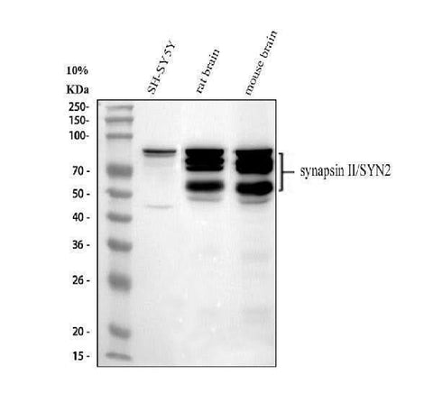 Anti-Synapsin II/SYN2 Antibody Picoband® Boster Bio