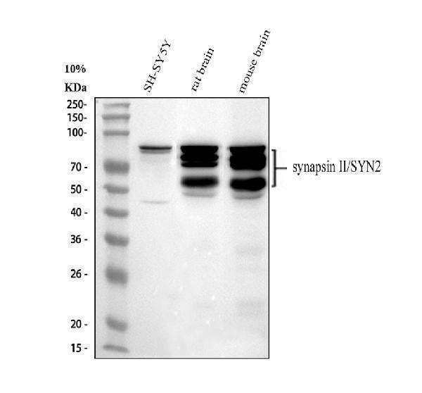 Anti-Synapsin II/SYN2 Antibody Picoband® Boster Bio