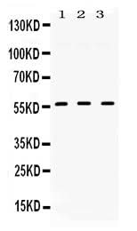 Anti-TGF beta Receptor I/TGFBR1 Antibody Picoband® Boster Bio
