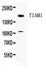 Anti-TIAM1 Antibody Picoband® Boster Bio