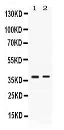 Anti-TNFRSF14 Antibody Picoband® Boster Bio
