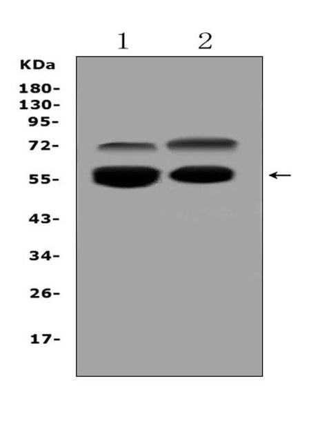 Anti-VNN1 Antibody Picoband® Boster Bio
