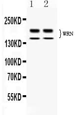 Anti-Werner's syndrome helicase WRN/WRN Antibody Picoband® Boster Bio