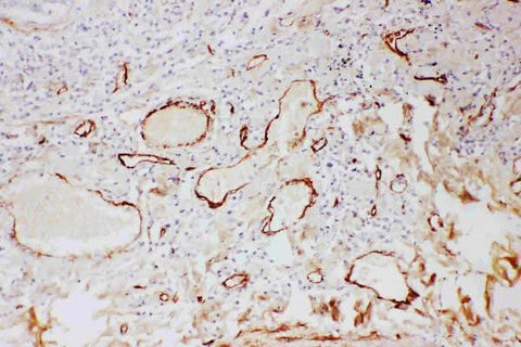 Anti-Adiponectin/ADIPOQ Antibody Picoband® Boster Bio