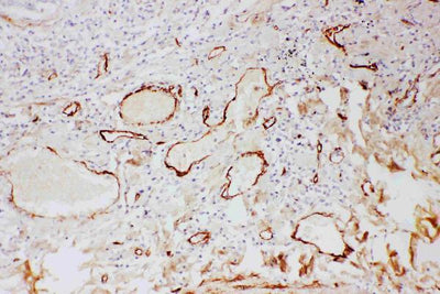 Anti-Adiponectin/ADIPOQ Antibody Picoband® Boster Bio